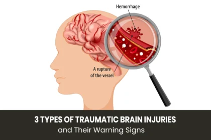 Types of traumatic brain injuries and warning signs
