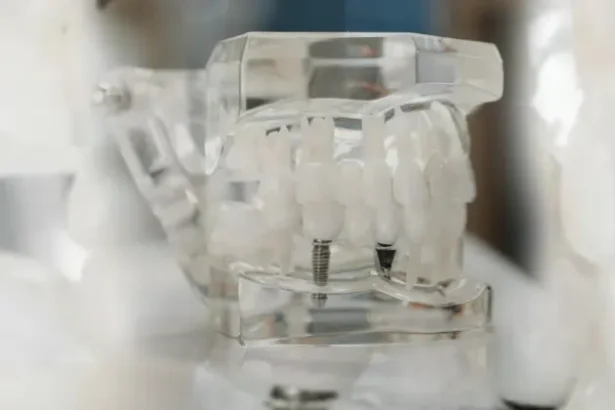 The Advantages of Dental Implants over Traditional Dentures