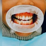 When to See a Periodontist in Atlanta, GA for Gum Health