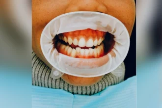 When to See a Periodontist in Atlanta, GA for Gum Health