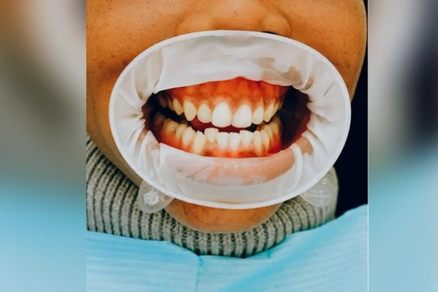 When to See a Periodontist in Atlanta, GA for Gum Health