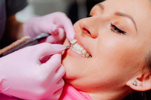 What to Know Before Getting Dental Veneers in Las Vegas