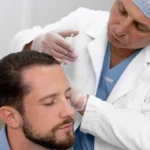 How Technology Helps Hair Transplant Specialists Personalize Results