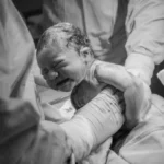 Signs of Birth Injuries and Legal Options in Indianapolis